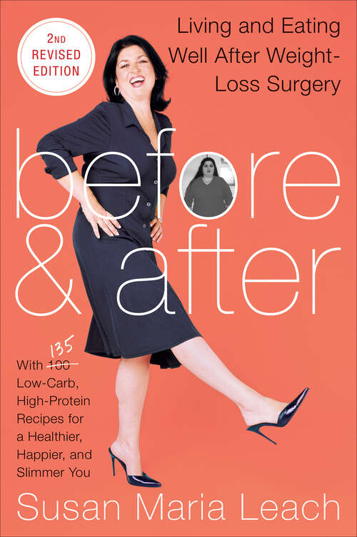 Book cover of Before & After: Living and Eating Well After Weight-Loss Surgery