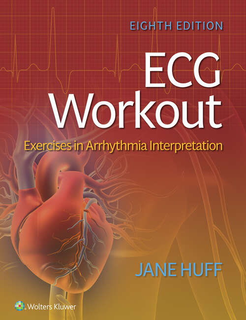 Book cover of ECG Workout: Exercises in Arrhythmia Interpretation