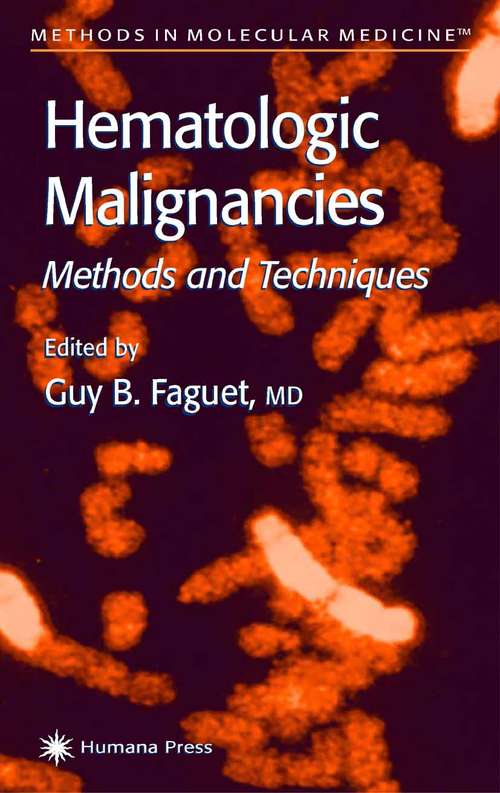 Book cover of Hematologic Malignancies