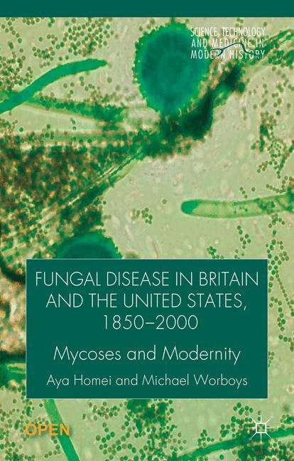 Book cover of Fungal Disease in Britain and the United States 1850�2000