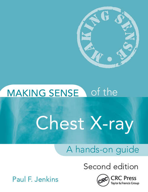 Making Sense of the Chest X-ray: A hands-on guide (Making Sense Of Ser.)