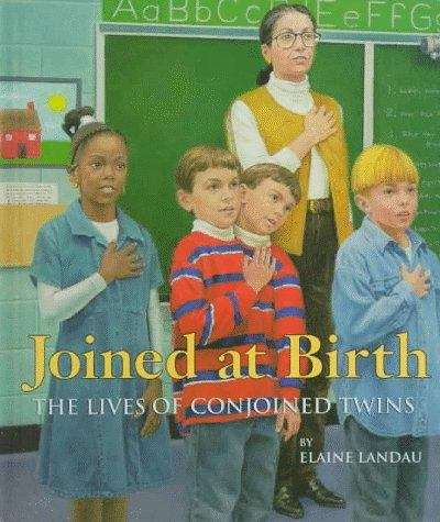 Book cover of Joined at Birth: The Lives of Conjoined Twins