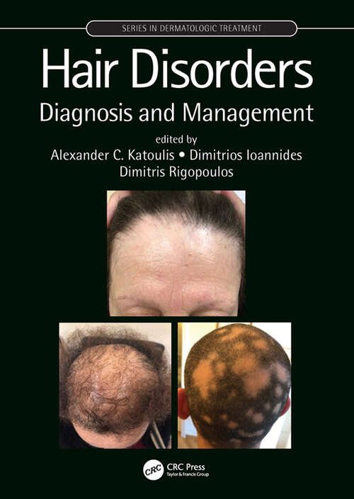 Hair Disorders: Diagnosis and Management (Series in Dermatological Treatment)