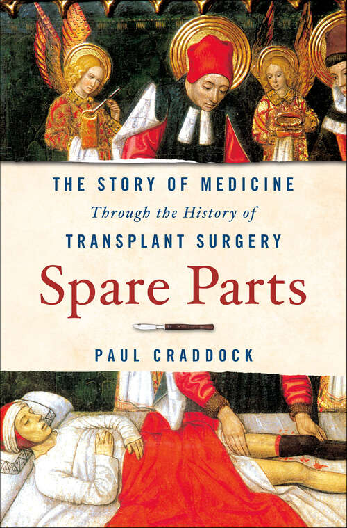 Book cover of Spare Parts: The Story of Medicine Through the History of Transplant Surgery