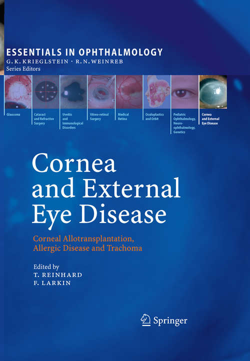 Book cover of Cornea and External Eye Disease