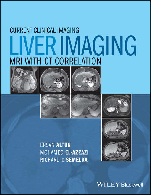 Book cover of Liver Imaging