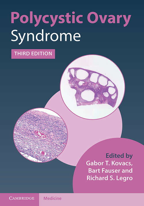 Polycystic Ovary Syndrome: Current Controversies, From The Ovary To The Pancreas (Contemporary Endocrinology Ser.)