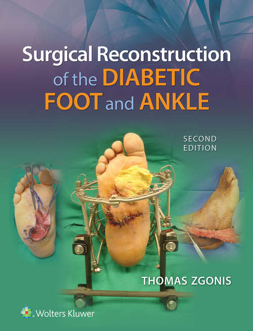 Book cover of Surgical Reconstruction of the Diabetic Foot and Ankle (2)