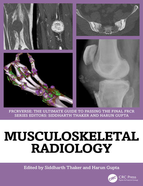 Book cover of Musculoskeletal Radiology: An Ultimate Guide to Passing the Final FRCR (1) (FRCRverse)