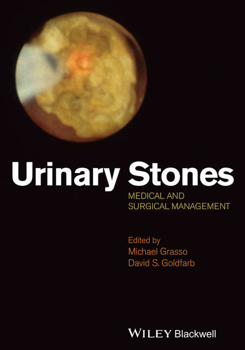 Book cover of Urinary Stones