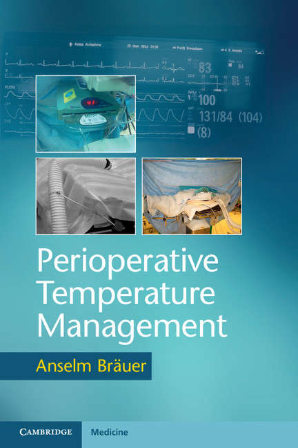 Book cover of Perioperative Temperature Management
