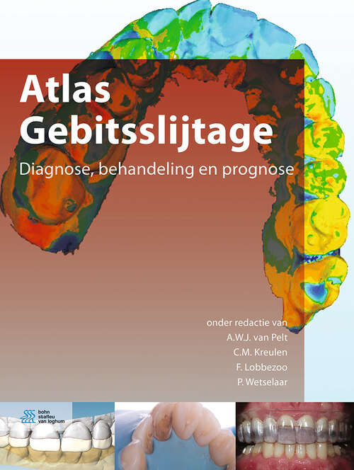 Atlas Gebitsslijtage