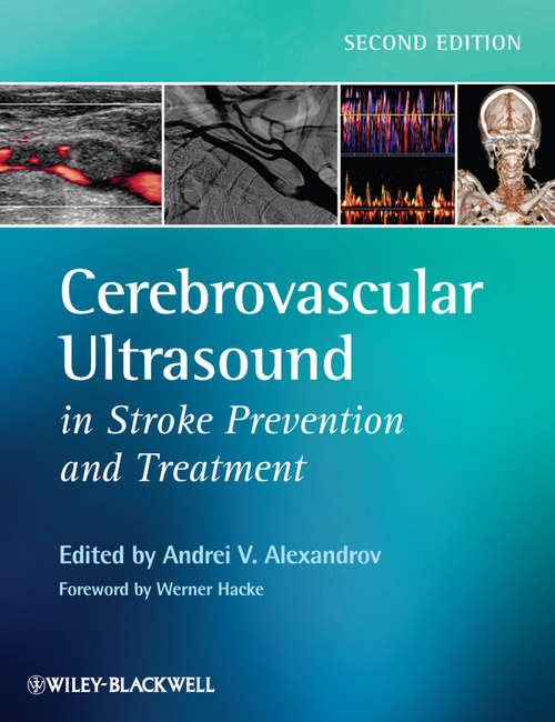 Book cover of Cerebrovascular Ultrasound in Stroke Prevention and Treatment