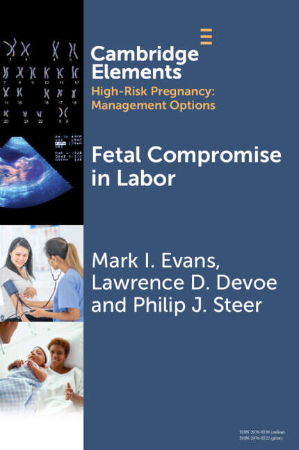 Book cover of Fetal Compromise in Labor (Elements in High Risk Pregnancy: Management Options)
