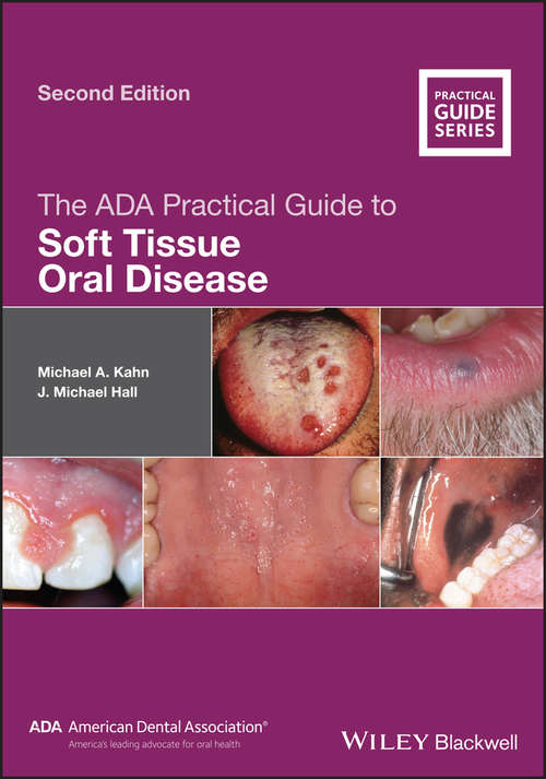 The ADA Practical Guide to Soft Tissue Oral Disease (ADA Practical Guide)