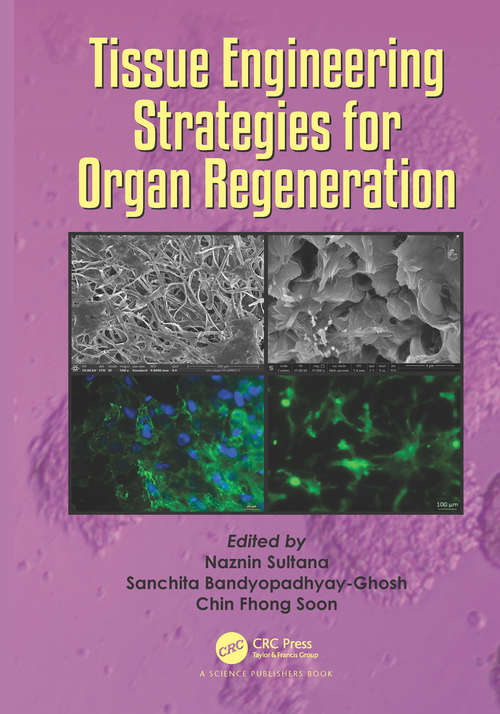 Tissue Engineering Strategies for Organ Regeneration