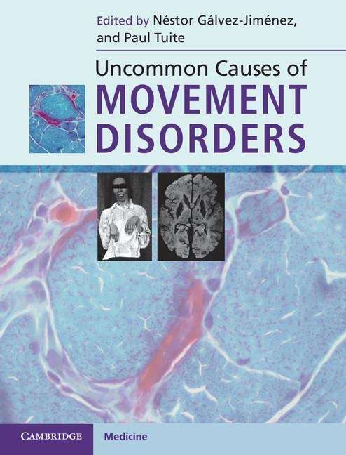 Book cover of Uncommon Causes of Movement Disorders