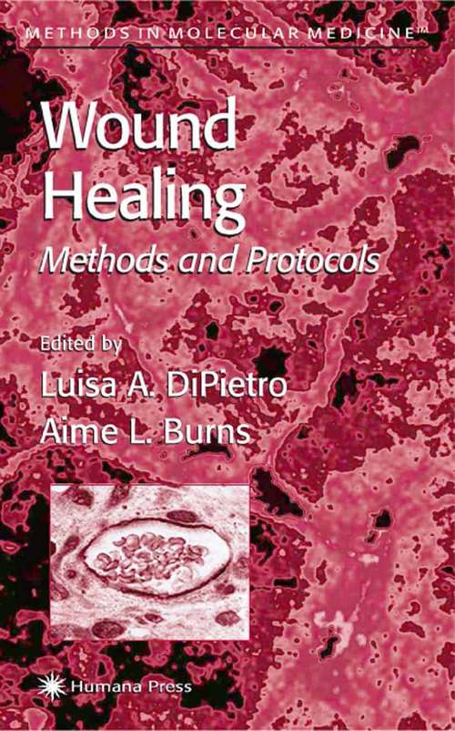 Book cover of Wound Healing