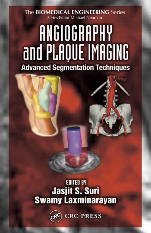 Angiography and Plaque Imaging: Advanced Segmentation Techniques (Biomedical Engineering Ser.)