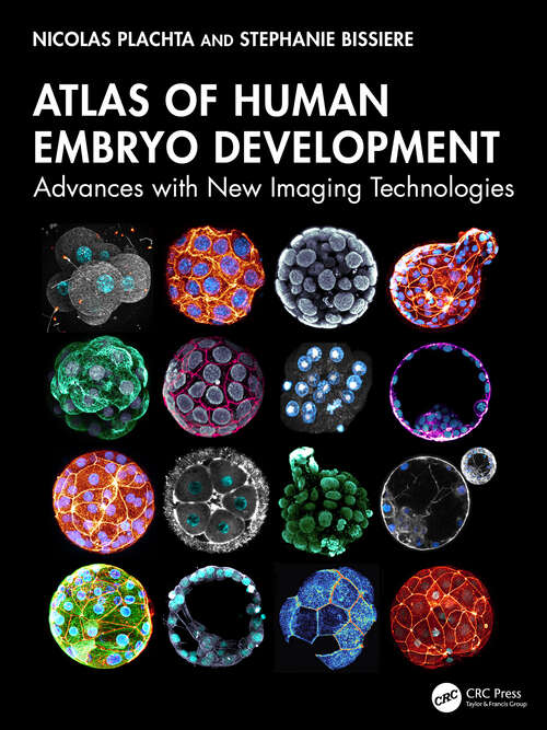 Book cover of Atlas of Human Embryo Development: Advances with New Imaging Technologies (1)