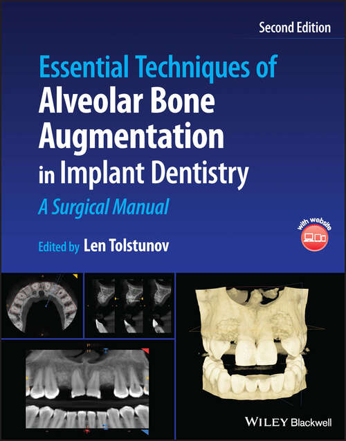 Book cover of Essential Techniques of Alveolar Bone Augmentation in Implant Dentistry: A Surgical Manual (2)