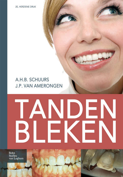Book cover of Tanden bleken