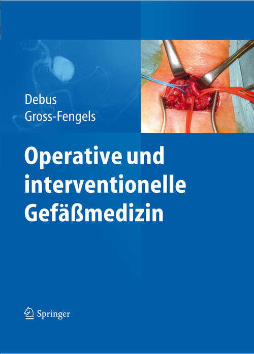 Book cover of Operative und interventionelle Gefäßmedizin