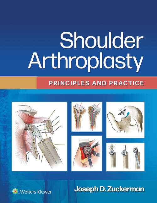 Book cover of Shoulder Arthroplasty