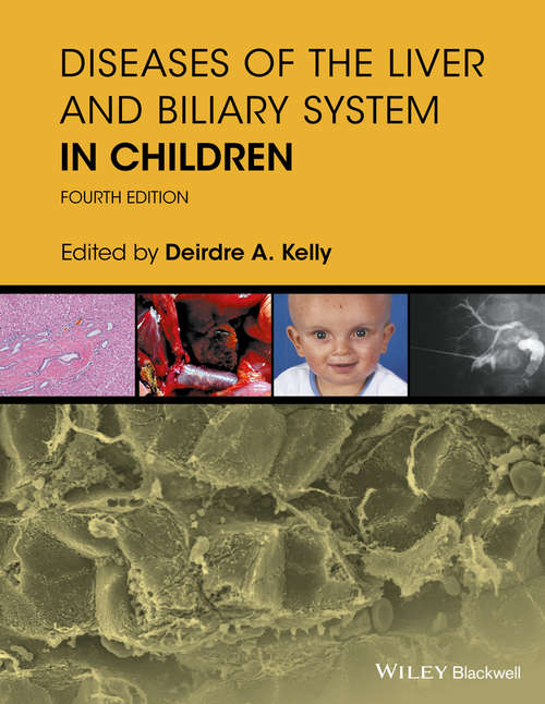 Book cover of Diseases of the Liver and Biliary System in Children