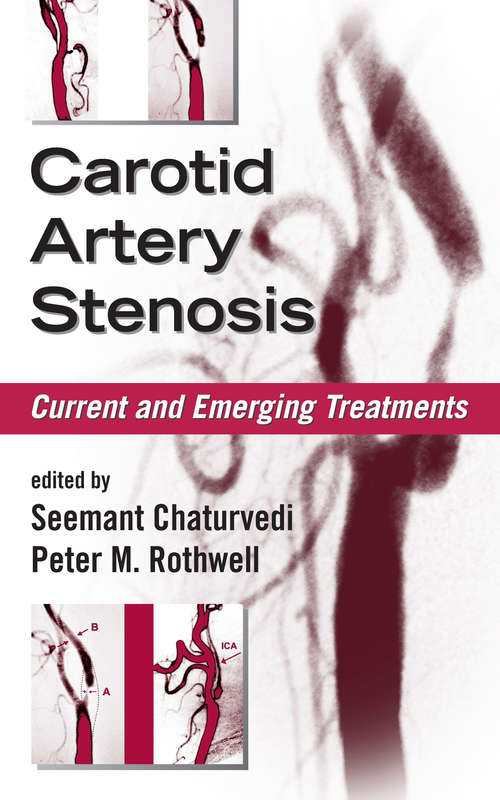 Carotid Artery Stenosis: Current and Emerging Treatments (Neurological Disease And Therapy Ser.)