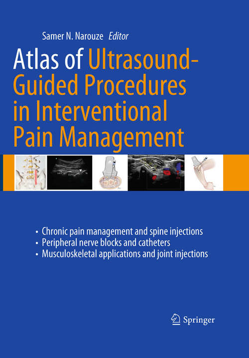 Book cover of Atlas of Ultrasound-Guided Procedures in Interventional Pain Management