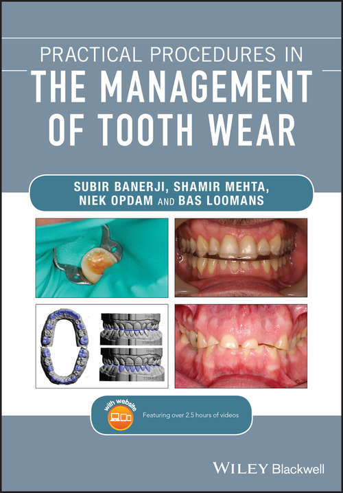Book cover of Practical Procedures in the Management of Tooth Wear