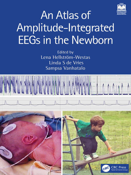 Book cover of An Atlas of Amplitude-Integrated EEGs in the Newborn (3)