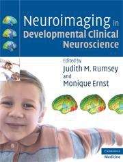 Book cover of Neuroimaging in Developmental Clinical Neuroscience