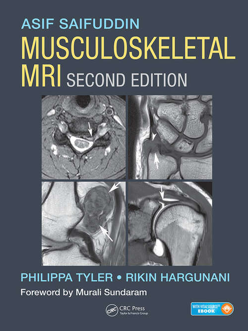 Book cover of Musculoskeletal MRI (2)