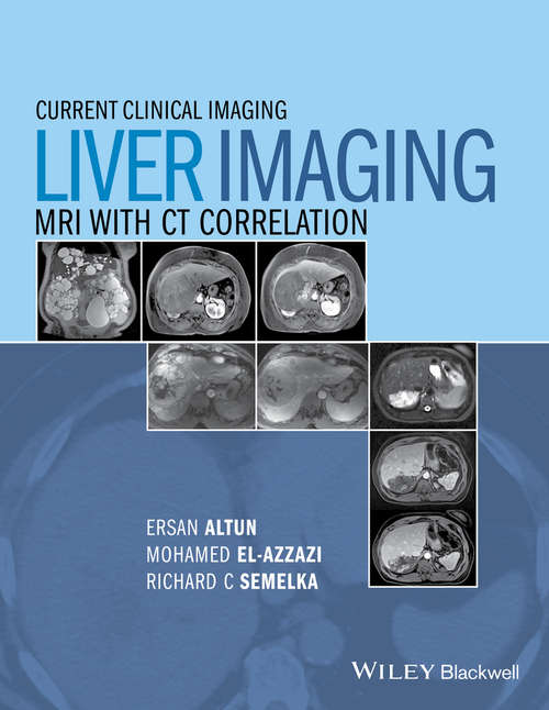Book cover of Liver Imaging