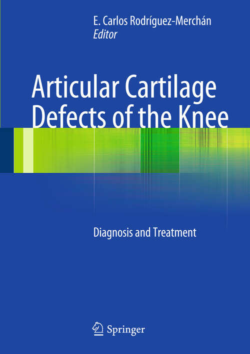Book cover of Articular Cartilage Defects of the Knee