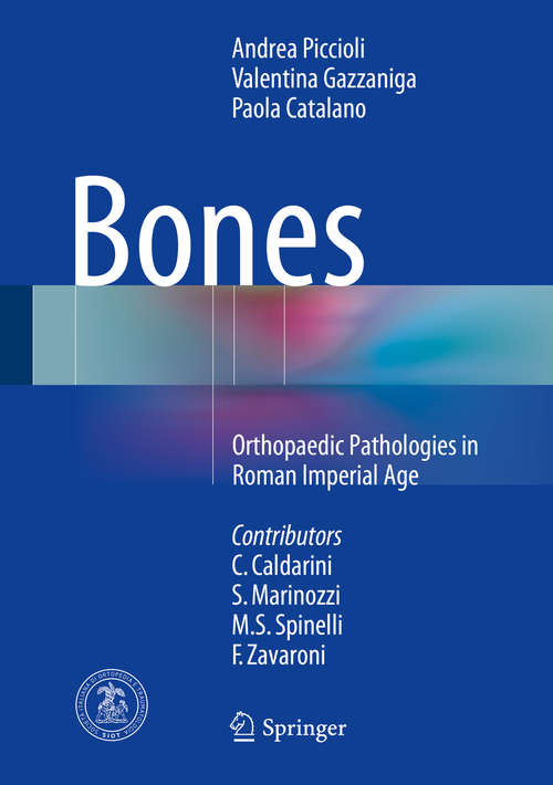 Book cover of Bones