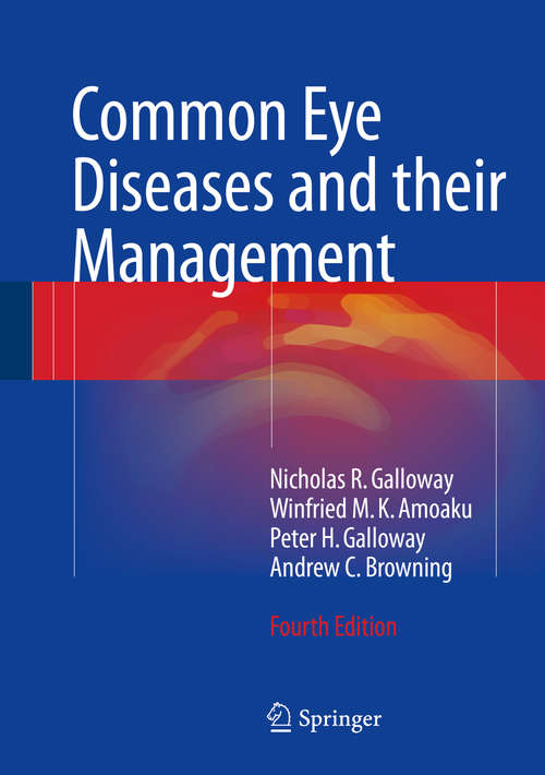 Book cover of Common Eye Diseases and their Management