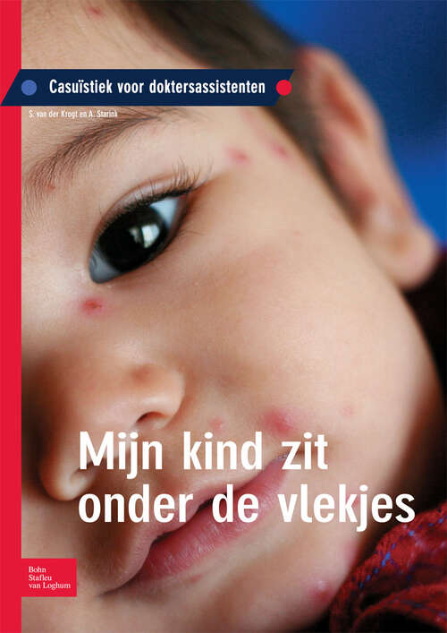 Book cover of Mijn kind zit onder de vlekjes