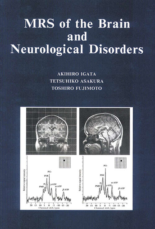 Book cover of MRS of the Brain and Neurological Disorders