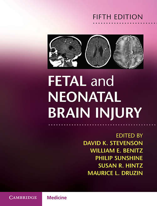 Fetal and Neonatal Brain Injury: Mechanisms, Management And The Risks Of Practice