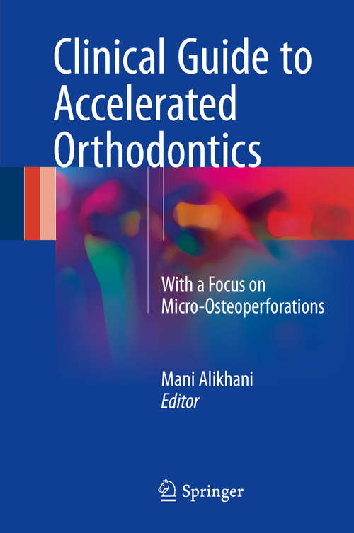 Book cover of Clinical Guide to Accelerated Orthodontics: With a Focus on Micro-Osteoperforations