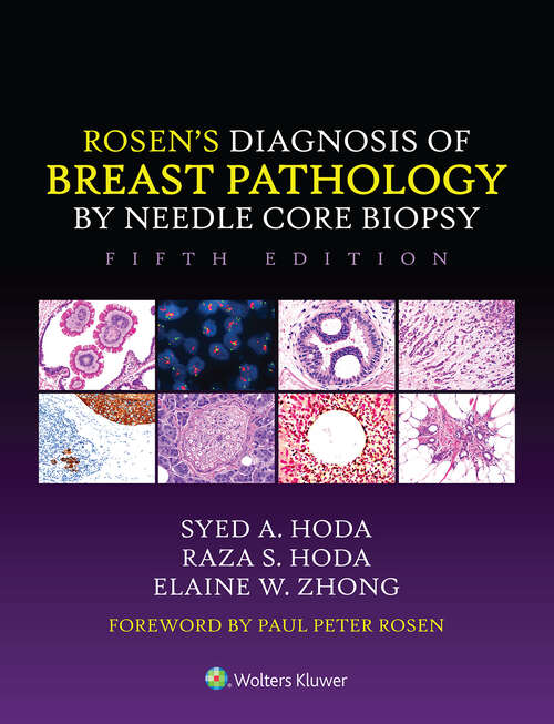 Cover image of Rosen's Diagnosis of Breast Pathology by Needle Core Biopsy