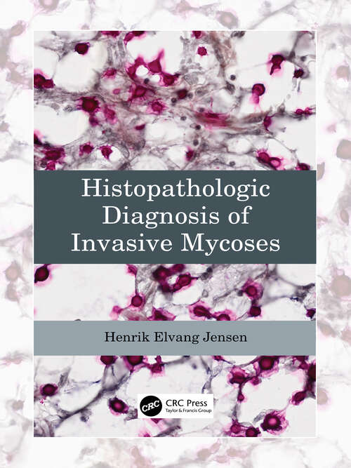 Book cover of Histopathologic Diagnosis of Invasive Mycoses