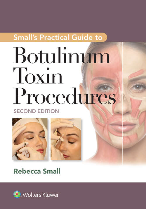 Book cover of Small's Practical Guide to Botulinum Toxin Procedures