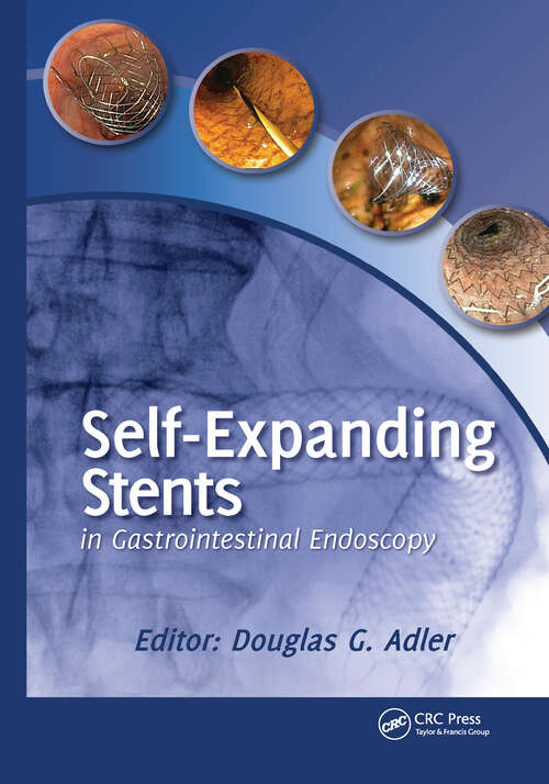Book cover of Self-Expanding Stents in Gastrointestinal Endoscopy
