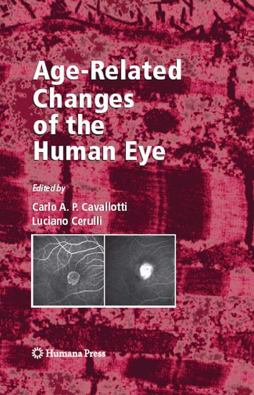 Book cover of Age-Related Changes of the Human Eye