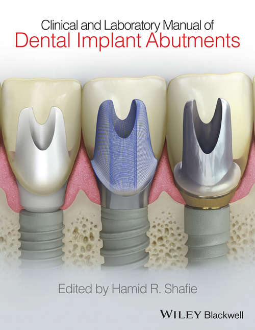 Book cover of Clinical and Laboratory Manual of Dental Implant Abutments