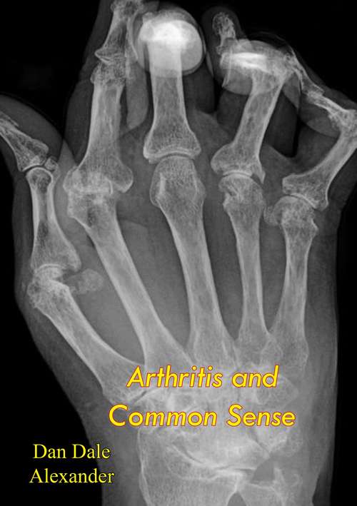 Book cover of Arthritis and Common Sense: With Illustrations And Menus (Cedar Bks.)